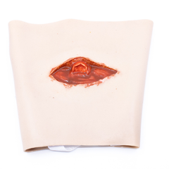 Aero Healthcare TRAUMASIM Wearable Open Femur Fracture - Upper Leg